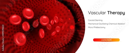 Vascular therapy concept. Blood veins and vessels illustration. Red blood cells in an artery.