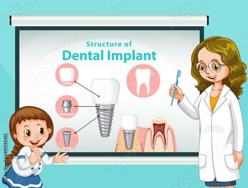 Infographic of human in structure of the dental implant
