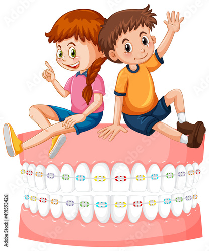 Happy children sitting on teeth braces with white background.