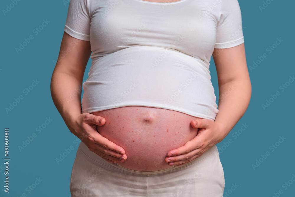 Acne on stomach deals