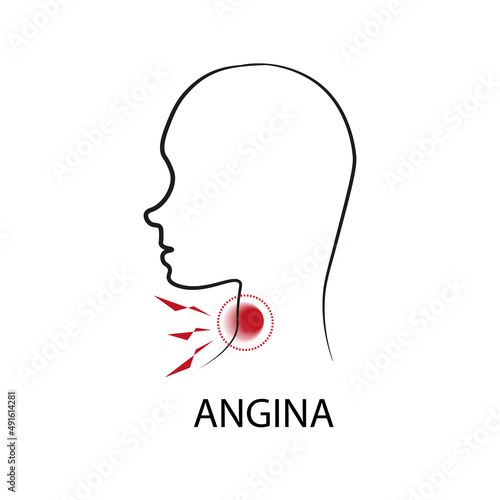 Vector illustration of angina.Profile Silhouette with Ache Location. Design for medical packaging of medicines