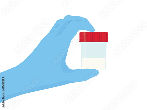 hand holding medical sperm sample- vector illustration