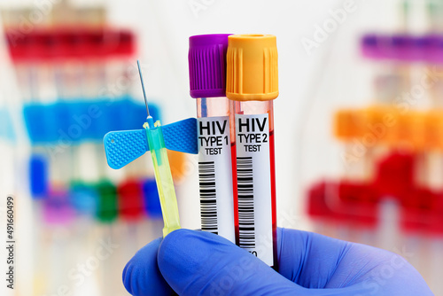 Фотография doctor with Blood tubes and needle for HIV Type 1 and type 2 test in biochemistry lab