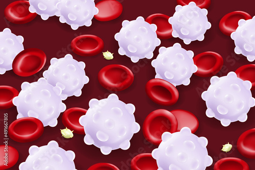 Leukemia. Red blood cells, White blood cells and platelets.