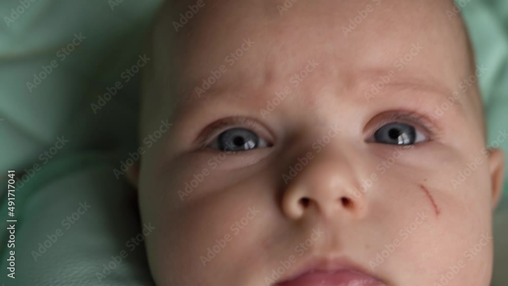 Close-up of a baby's face. The frowning child looks into the camera with large, wide eyes. Scratch on the cheek. Light eyebrows, black eyelashes, nose. Glare in the eyes. Day. Flat. Static camera Close-up of a baby's face. The frowning child looks into the camera with large, wide eyes. Scratch on the cheek. Light eyebrows, black eyelashes, nose. Glare in the eyes. Day. Flat. Static camera