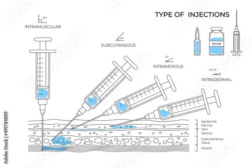 Types of injections. Guide to injecting vaccines into skin. Medical procedure manuals for hospital workers. Set vector illustration
