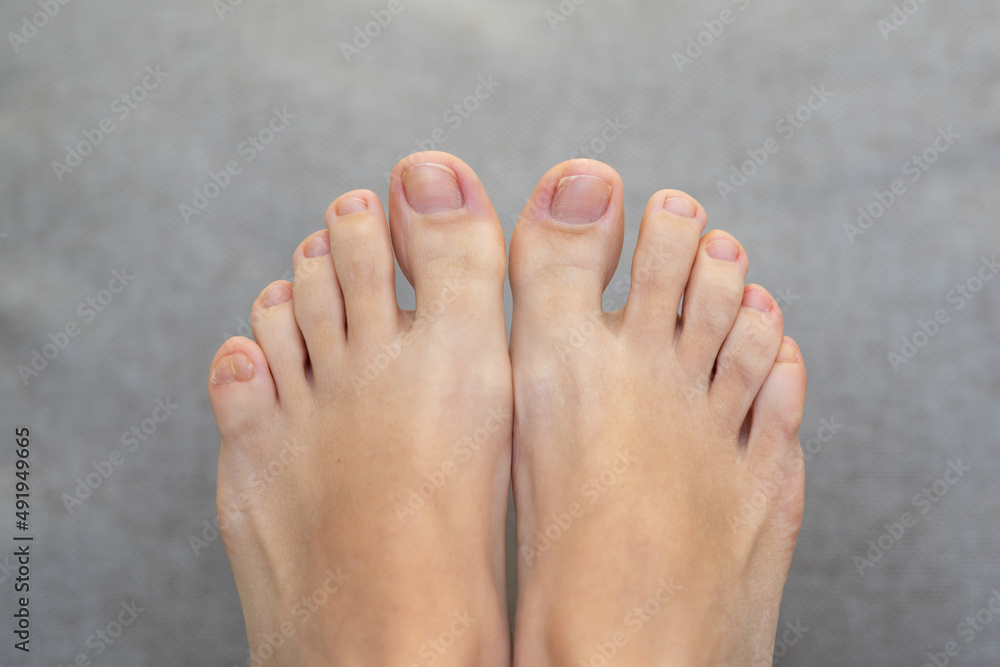 Closeup of female feet and toes on white background. Healthy feet concept  Stock Photo