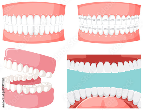 Set of teeth inside human mouth with human teeth model