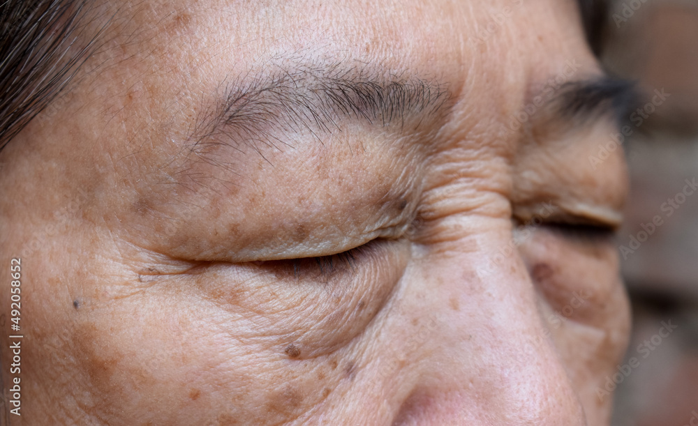 Wrinkles around closed eye of Asian elder woman. Wrinkles around closed eye of Asian elder woman.