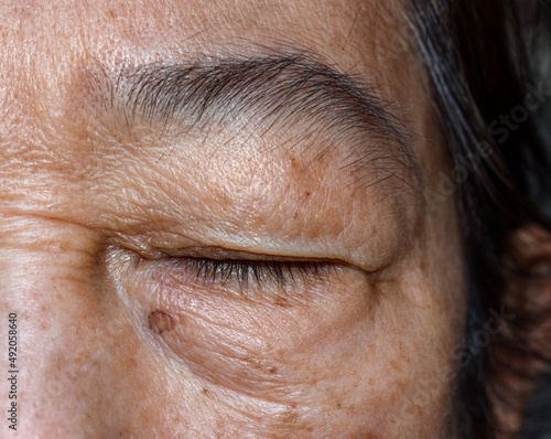 Wrinkles around closed eye of Asian elder woman. photo