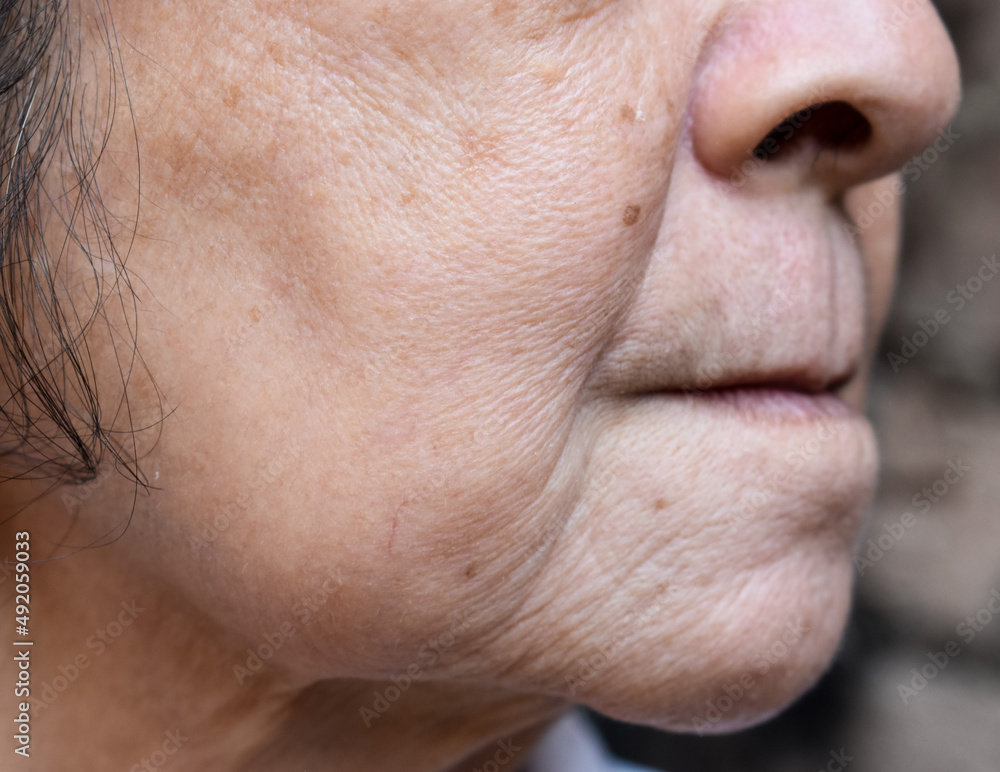 Fototapeta premium Enlarged pores in face of Asian, elder woman with skin folds.