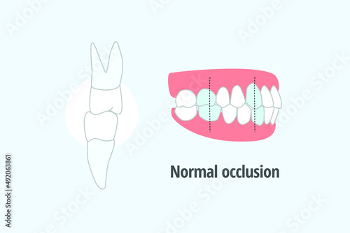 icon dental problem. vectorial illustration Normal occlusion