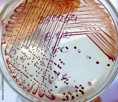 Tableau sur toile Bacteria colony of Escherichia coli (E