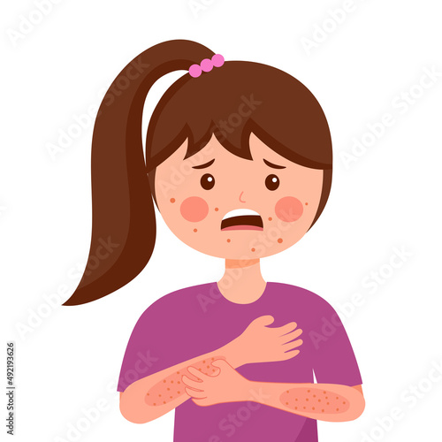 Girl children scratching arm. Kids suffering from strong allergy skin itchy symptom in flat design. Red rash skin irritation.
