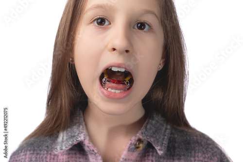 A cute little girl shows an orthodontic appliance in her mouth. The concept of teeth alignment in childhood. Studio photo on a white background.