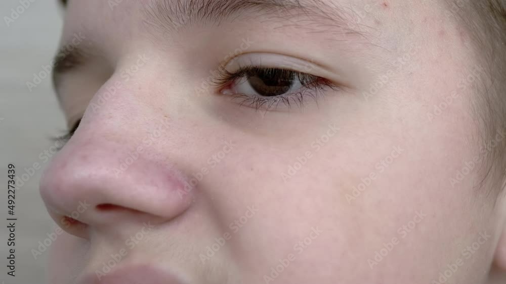 Close-up of Face Blinking Child with Brown Eyes, Long Eyelashes at the Camera. Beautiful boy fast opening and closing eyes. Side view. Children emotions. Part of a teenager face. Poor eyesight. 4K. Close-up of Face Blinking Child with Brown Eyes, Long Eyelashes at the Camera. Beautiful boy fast opening and closing eyes. Side view. Children emotions. Part of a teenager face. Poor eyesight. 4K.