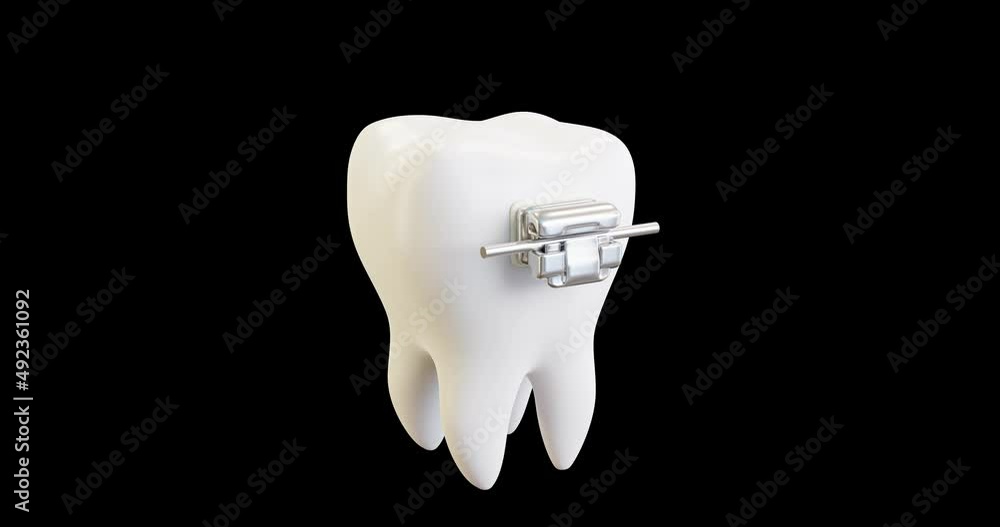 3d video installation of the arc in the lock, braces without ligatures