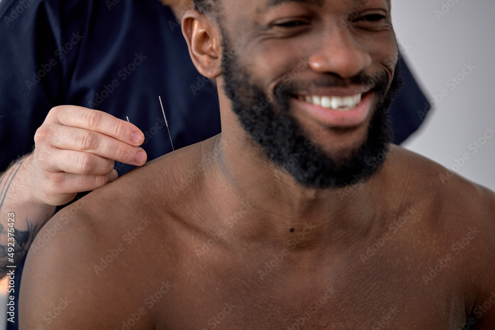 © alfa27 - needle acupuncture procedure. acupuncturist doctor makes therapy for excited black man, sit smiling, having fun, enjoying procedure treatment. cropped doctor and client in hospital clinic