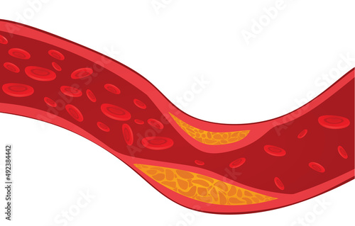 Vascular blood artery. vector illustration