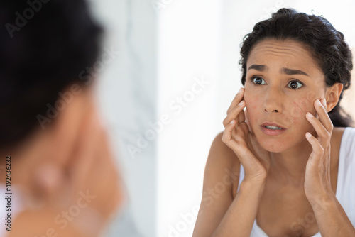 Atopic Skin Concept. Worried Young Woman Looking At Mirror And Touching Face Free Download Atopic Skin Concept. Worried Young Woman Looking At Mirror And Touching Face - GFXLoad