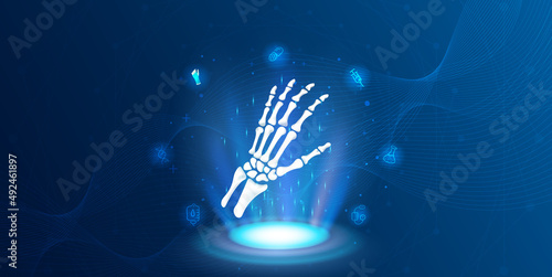 Technology for treatment of hand bone. Abstract traumatology and orthopedics. Medical science in the hospital for body joints.