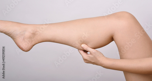 Vászonkép Calf fat, Fat woman pinching thigh leg skin, Overweight body test