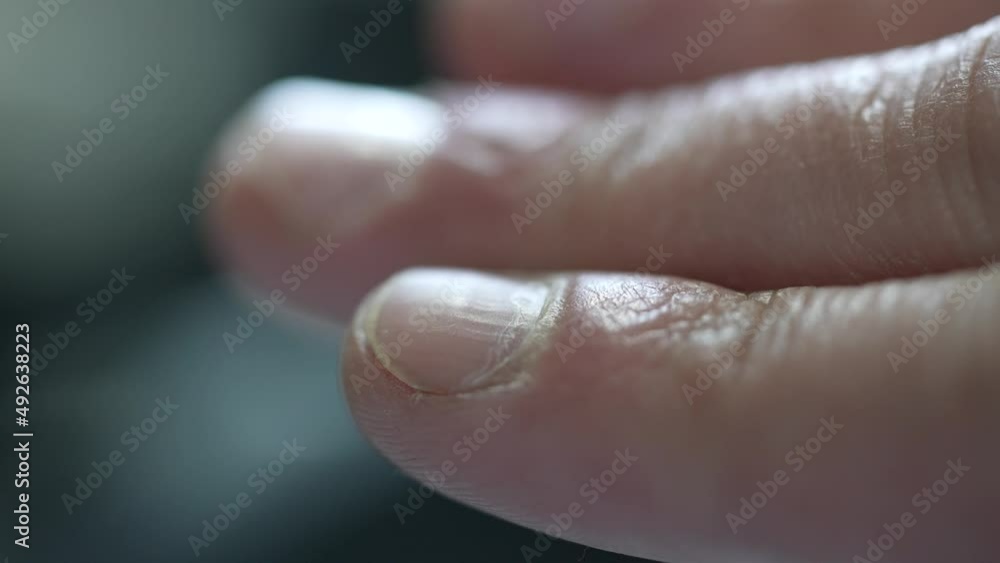 bitting nails finger. anxiety, worry and nervous concept. bad habit bitting nails finger. anxiety, worry and nervous concept. bad habit