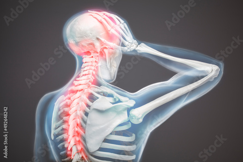 Neck and back pain, cervical vertebrae spine, human body anatomy