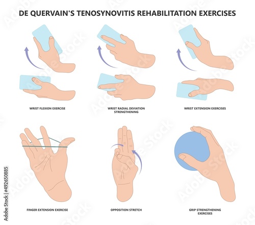 De quervain's pain tendon thumb wrist hurt grasp make a fist sport muscle hand Finkelstein's test bend brace finger strain trigger carpal tunnel brevis Eichhoff's stretch radial Grip spring relief photo