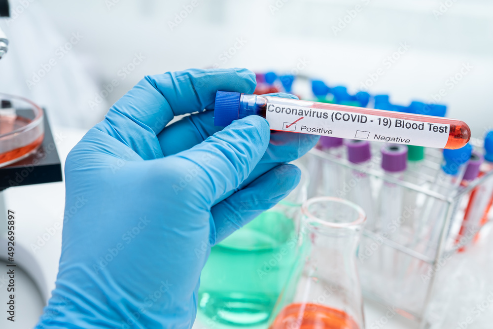 Positive blood infection sample in test tube for covid-19 coronavirus in lab. Scientist holding to check and analyze for patient in hospital. Positive blood infection sample in test tube for covid-19 coronavirus in lab. Scientist holding to check and analyze for patient in hospital.