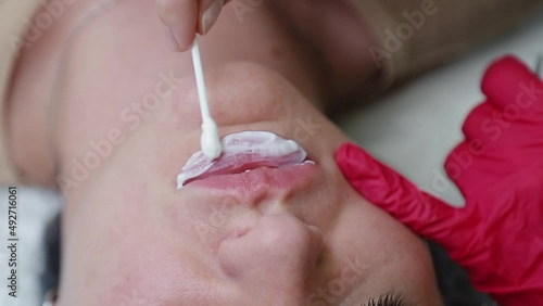 cosmetic procedure on the lips, a cosmetic product is applied with a cotton swab