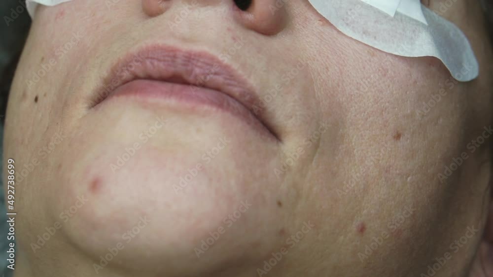 Close-up of the eyelash extension process. Close-up of the eyelash extension process.