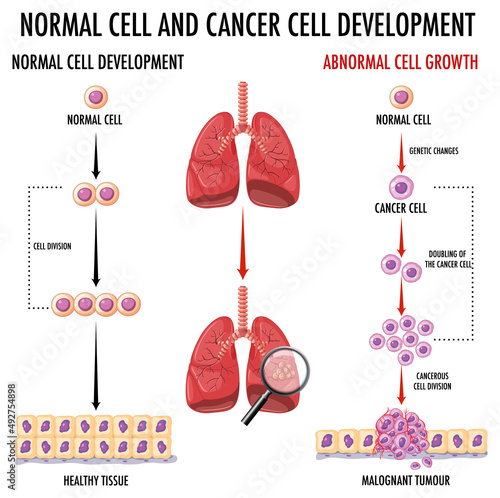 Diagram showing normal and cancer cells in human