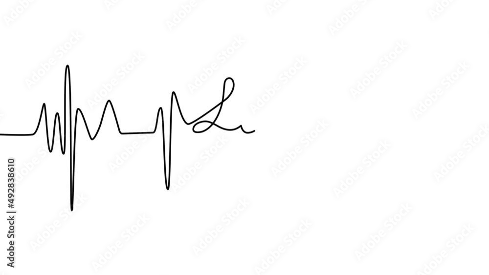Self draws line heartbeat and heart, lettering love. electrocardiogram medical screen with a graph of heart rhythm Self draws line heartbeat and heart, lettering love. electrocardiogram medical screen with a graph of heart rhythm