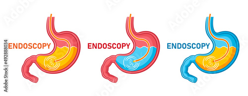 Endoscopy stomach, gastroscopy icon set. Gastroenterology endoscope, medical examination digestive tract system, treatment gastritis, heartburn, ulcer internal organ. Health care procedure flat vector