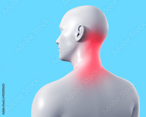 3d render artwork illustration of male gray colored figure with neck inflammation on blue background.