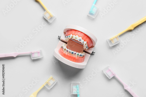 Model of jaw with dental braces and toothbrushes on light background photo