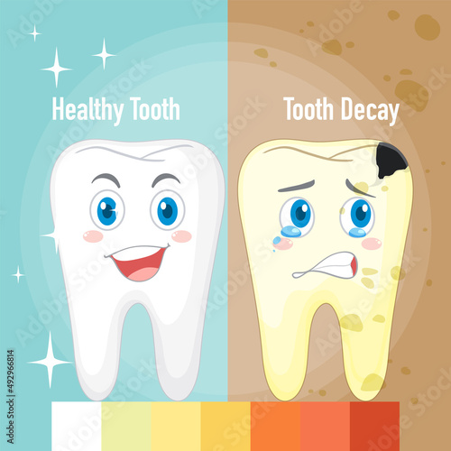 Infographic of healthy tooth and tooth decay