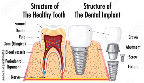 Infographic of human in structure of the healthy tooth