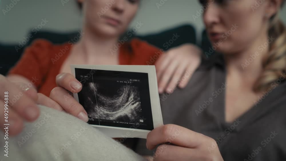 Hand holding ultrasound scan and two women in the background. Shot with RED helium camera in 8K. Hand holding ultrasound scan and two women in the background. Shot with RED helium camera in 8K.