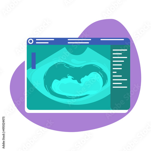 Fetal ultrasound 2D vector isolated illustration. Checking unborn baby condition flat sticker on cartoon background. Imaging pregnancy. Sonogram colourful scene for mobile, website, presentation