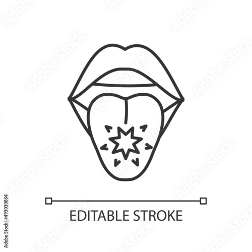 Tongue cancer linear icon. Malignant tumors and sores. Mouth and oral cancer. Abnormal cells growth. Thin line illustration. Contour symbol. Vector outline drawing. Editable stroke. Arial font used