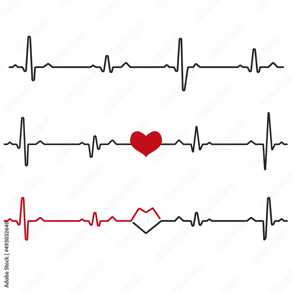 Set of black heartbeats isolated on white background. Electro-cardiogram, pulse of heart Design element for medicine, healthcare. Vector illustration. EPS10. Set of black heartbeats isolated on white background. Electro-cardiogram, pulse of heart Design element for medicine, healthcare. Vector illustration. EPS10.