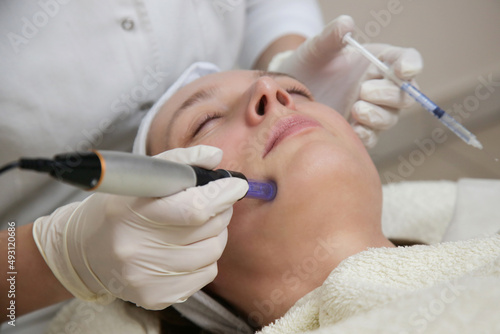 Mesotherapy. Woman having dermapen facial treatment.
Micro needle cosmetic treatment at dermatologist. photo