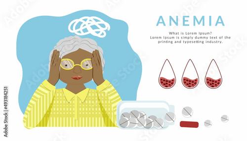 Elderly woman is holding her head and feeling tired, weak due to lack of iron in her serum. The concept of anemia. Decreased number of red blood cells or low hemoglobin. Open can of pills, vitamins.