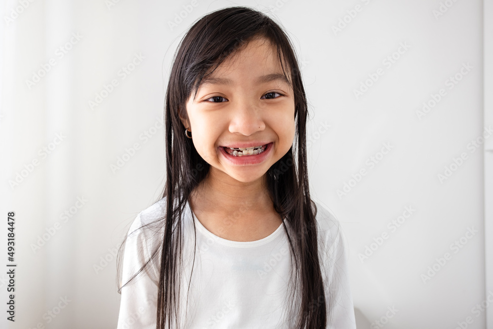 Asian girl wearing removable braces is smiling in a good mood. Asian girl wearing removable braces is smiling in a good mood.