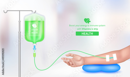 Intravenous vitamin iv drip treatment in spa salon, clinic. Serum collagen vitamin inside saline bag green. Used for giving injections for health. Vector EPS 10.