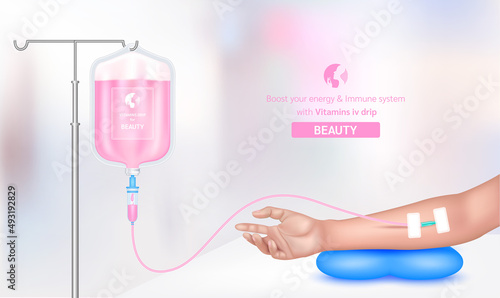 Intravenous vitamin iv drip treatment in spa salon, clinic. Serum collagen vitamin inside saline bag for beauty pink. Used for giving injections for health. Vector EPS 10.