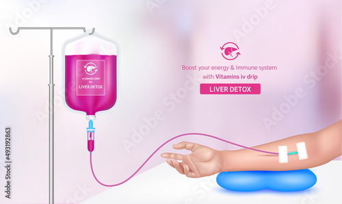 Intravenous vitamin iv drip treatment in spa salon, clinic. Serum collagen vitamin purple inside saline bag for liver detox. Used for giving injections for health. Vector EPS 10.