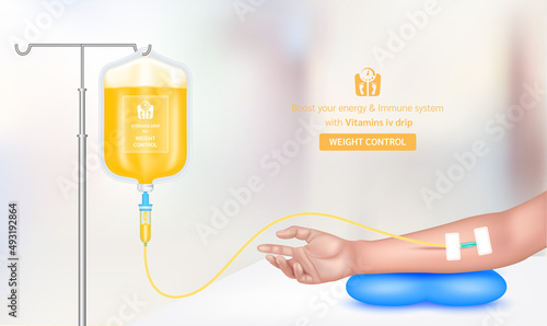 Intravenous vitamin iv drip treatment in spa salon, clinic. Serum collagen vitamin orange inside saline bag for weight control. Used for giving injections for health. Vector EPS 10.